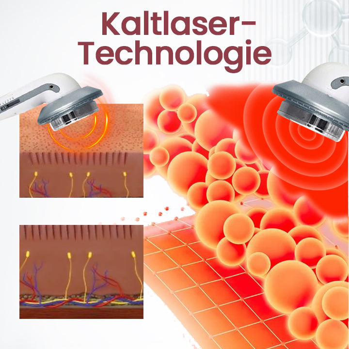 Ceoerty™ PainErase Kaltlaser Schmerzlinderer