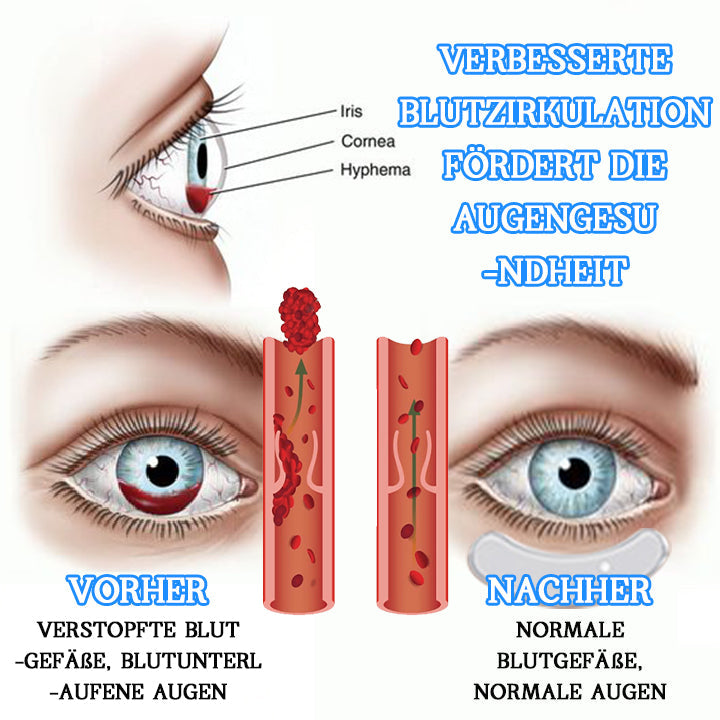 Biancat™ VisionPro Mikrostrom Beheiztes Okular Vitalitätsgerät