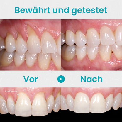 Ceoerty™ Zahnfleischschutz-Therapie-Gel