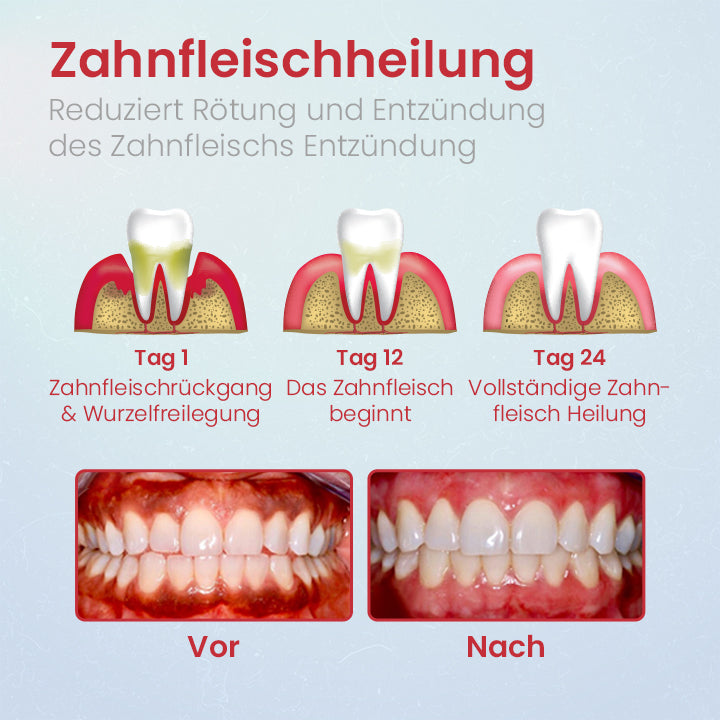 Ceoerty™ PRODent Probiotische Whitening-Zahnpasta