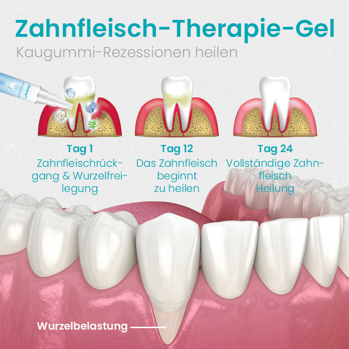 Ceoerty™ Zahnfleischschutz-Therapie-Gel