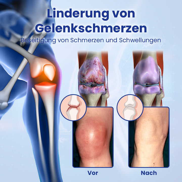 Ceoerty™ JointRenew Knochenreparatur-Gel-Rolle