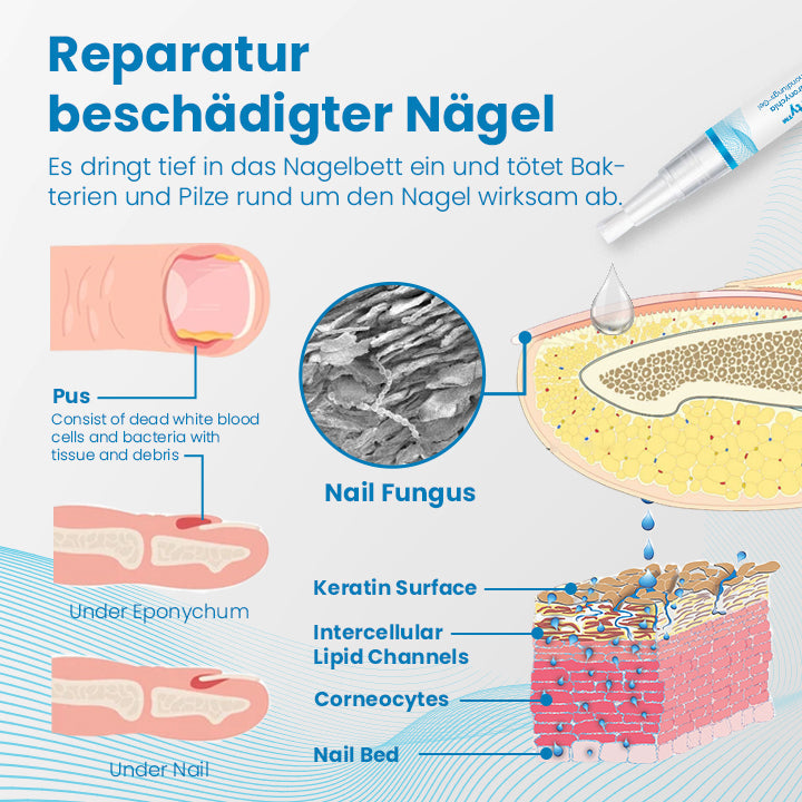 Ceoerty™ Anti-Paronychia Nagelbehandlungs-Gel