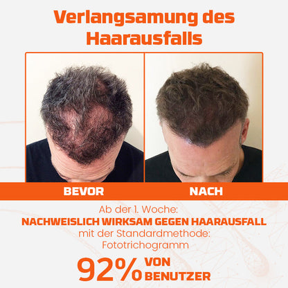 Ceoerty™ Haarwuchs Roll-On Behandlung