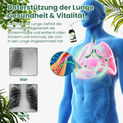 Ceoerty™ HerbaFresh Lungenreinigungsnebel